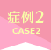 症例2