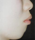 �p�O