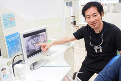 STEP4 マウスピース(アライナー)作成