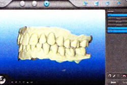 3Dシミュレーション