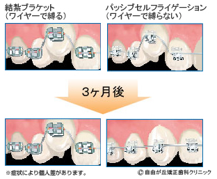 仕組み