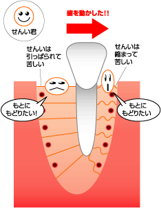 矯正治療によって歯に弱い力を加えると、歯根膜が伸縮します。