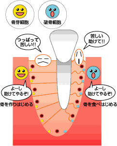 歯根膜の繊維はある一定の幅を維持しようとします。