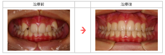 治療前後の比較