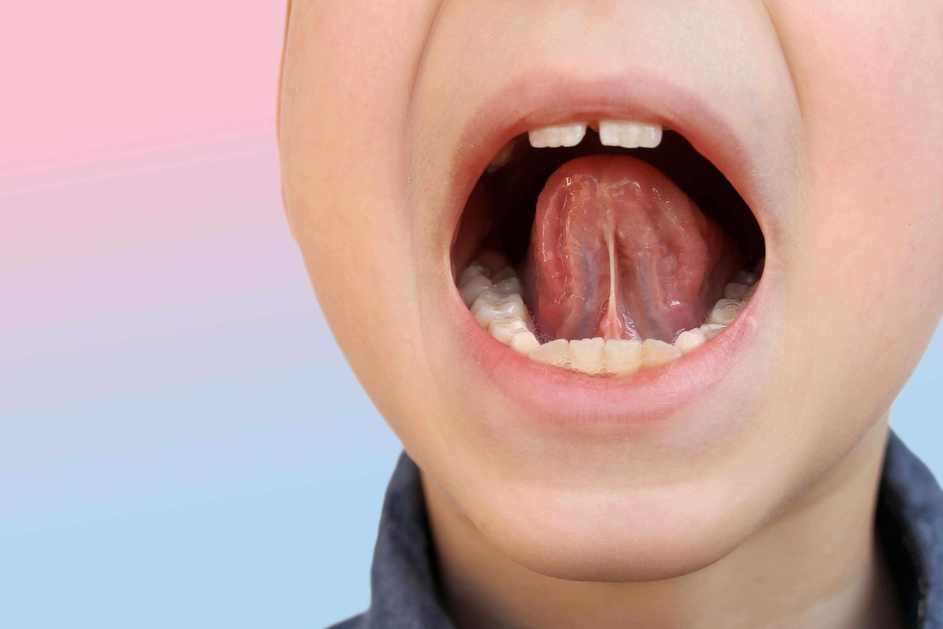 [MFT] 口のまわりの筋機能療法とは（3） - レッスン2-
