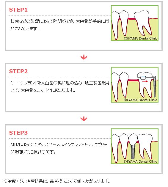 治療の流れ