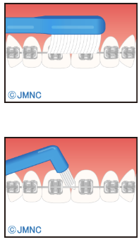 通常の歯ブラシや2列歯ブラシを使うコツ