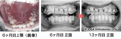 治療前と治療後の比較