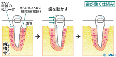 ブラケットによって歯が動く仕組み