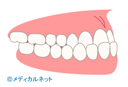 歯並び診断