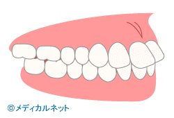 歯並び診断
