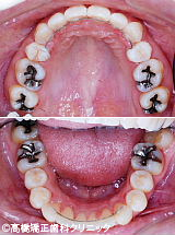 治療前と治療後の比較治療後