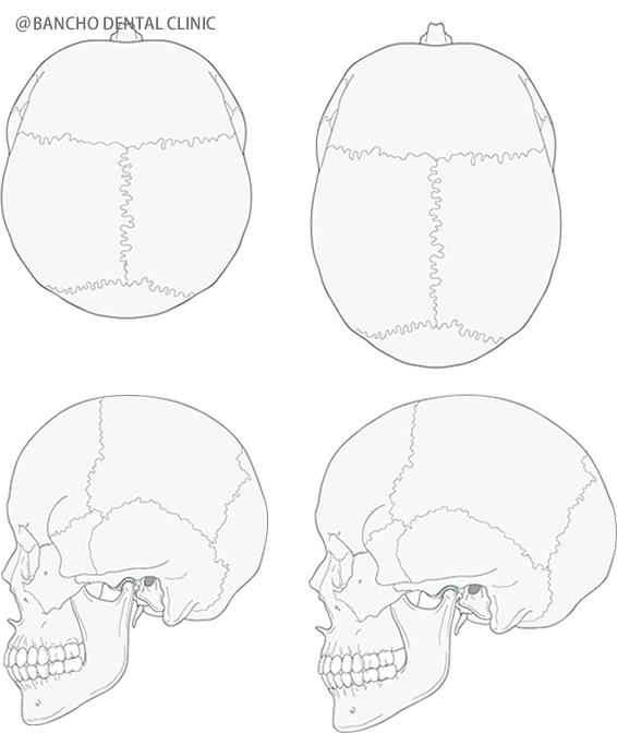 一般的な頭蓋骨を上からみたものと側方から見た骨格の形態