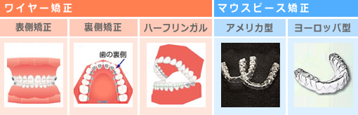 矯正歯科で使用される主な装置