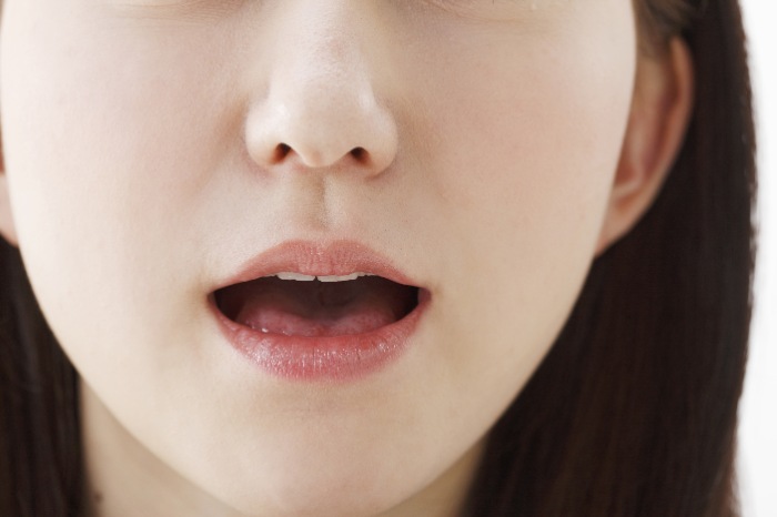 ガミースマイル（出っ歯）で口が閉じにくく、口腔内の環境が悪くなってしまっている