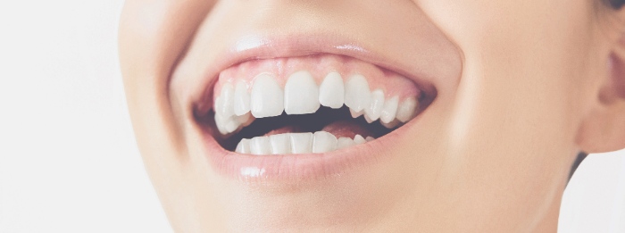 笑ったときに歯茎が見えてしまうガミースマイル
