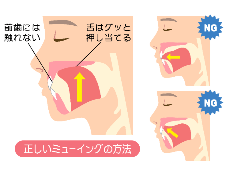 顎関節症