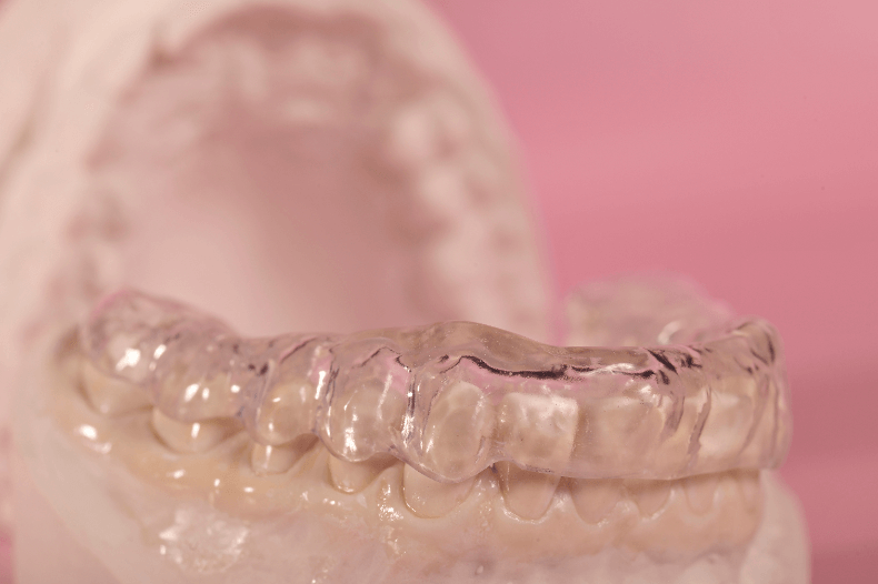 マウスピース矯正が原因で虫歯になることってあるの？