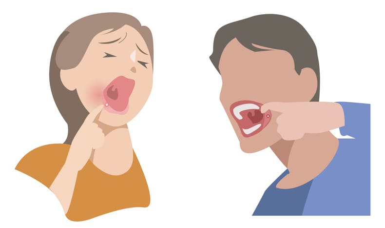 前歯2番 抜歯矯正
