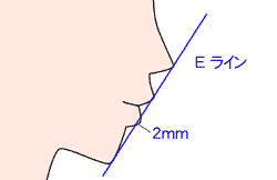 Eライン　軟組織の審美