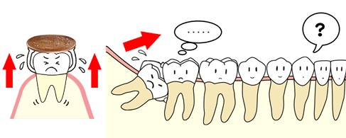 歯が生えてくる力ってどれくらい？