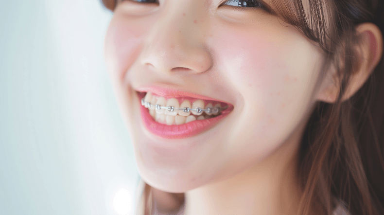 矯正 アンカースクリュー