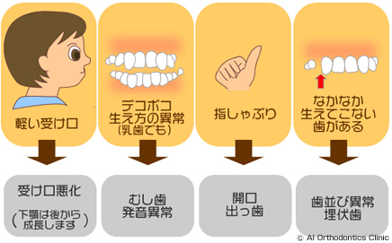 そのまま放置にしておくと、不正咬合が悪化する恐れのある症状・癖