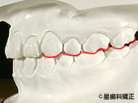 3.上下の歯がきちんと噛み合っているか