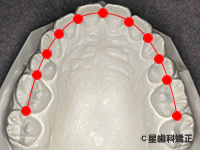 4.隣の歯との適切な場所に接しているか（コンタクトにズレがない）