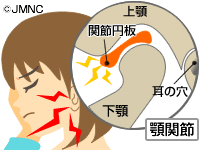 7.顎関節に負担のない噛み合わせ（ICPとRCPの著しいズレがない）