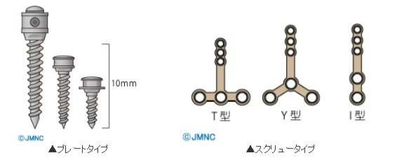 インプラント矯正とは