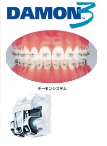 矯正のイメージを変える新しい装置・・・・デーモンシステム