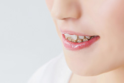 ΢¦¶ºÀµ¡¦¥Ï¡¼¥Õ¥ê¥ó¥¬¥ë¶ºÀµ¤ò¹Ô¤Ã¤Æ¤¤¤Þ¤¹