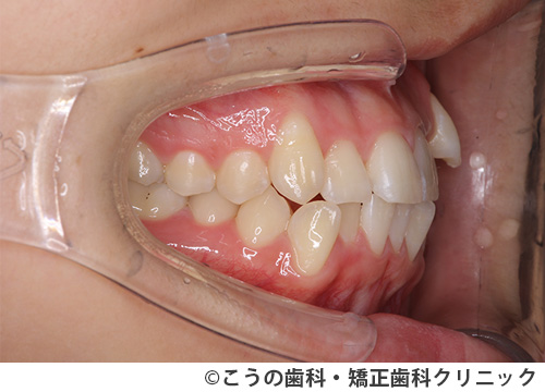 treat_case01_a1.jpg