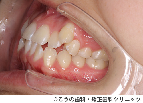treat_case01_a2.jpg