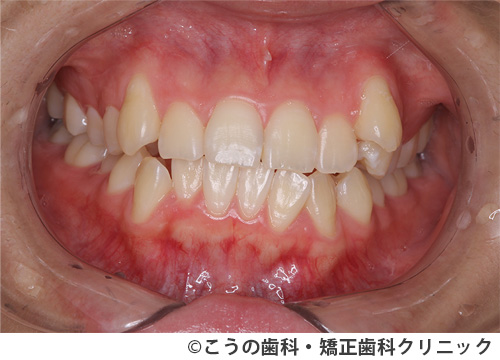 treat_case01_a3.jpg