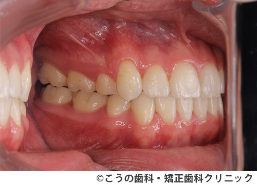 treat_case01_a2.jpg