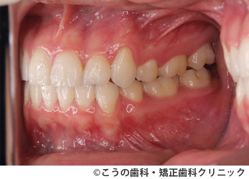 treat_case01_b2.jpg