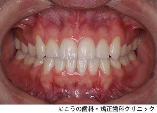 treat_case01_c2.jpg