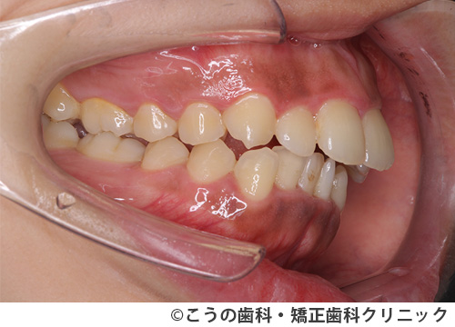 treat_case02_a1.jpg