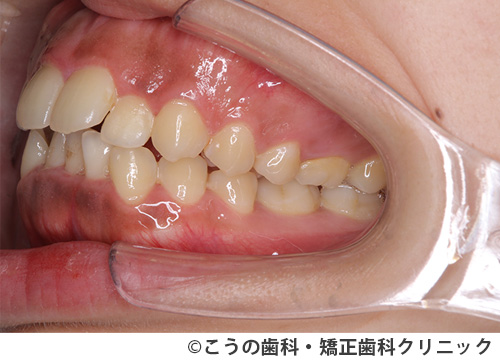 treat_case02_a2.jpg