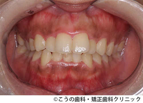 treat_case02_a3.jpg