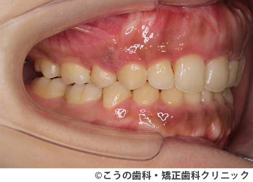 treat_case02_b1.jpg