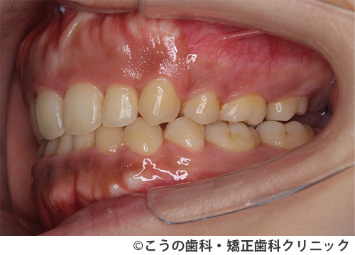 treat_case02_b2.jpg