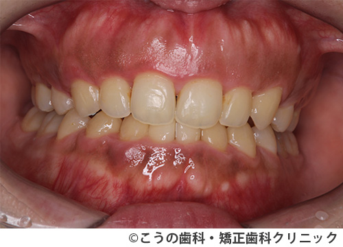 treat_case02_b3.jpg