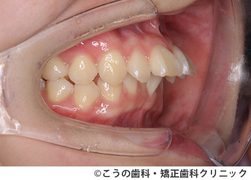 treat_case03_a1.jpg