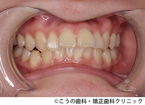 treat_case03_a3.jpg