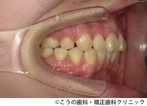 treat_case03_b1.jpg