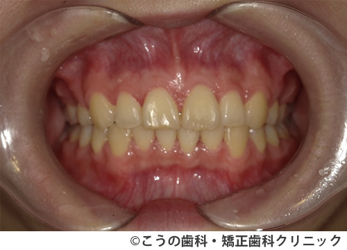 treat_case03_b3.jpg