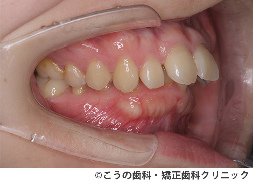treat_case04_a1.jpg
